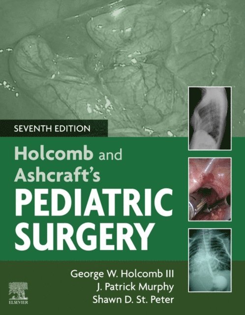 J. Patrick Murphy, George W. Holcomb, Shawn D. St Peter - Holcomb and Ashcraft's Pediatric Surgery E-Book, E-bok