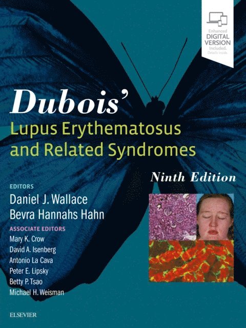 Bevra Hahn, Daniel J. Wallace - Dubois' Lupus Erythematosus and Related Syndromes - E-Book, E-bok
