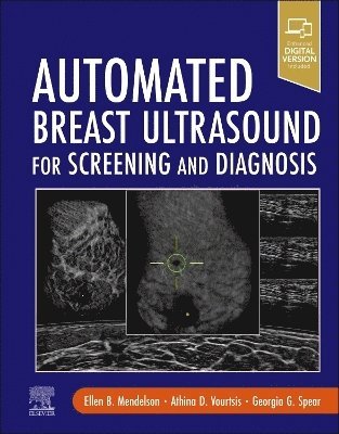 Ellen B. Mendelson, Athina Vourtsis, Georgia Giakoumis Spear, Ingolf Karst - Automated Breast Ultrasound for Screening and Diagnosis, Inbunden