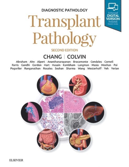 Matthew R Lindberg, Anthony C. Chang - Diagnostic Pathology: Transplant Pathology E-Book, E-bok