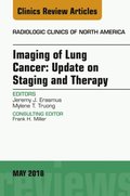 Lung Cancer, An Issue of Radiologic Clinics of North America