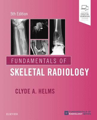 Fundamentals of Skeletal Radiology av Clyde A Helms