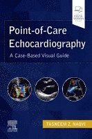 Point-of-Care Echocardiography