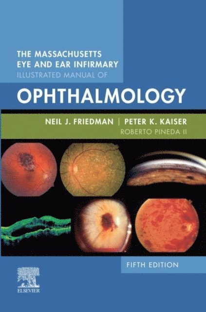 Roberto Pineda II, Peter K. Kaiser, Neil J. Friedman - Massachusetts Eye and Ear Infirmary Illustrated Manual of Ophthalmology E-Book, E-bok