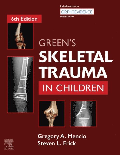 Gregory A Mencio - Green's Skeletal Trauma in Children E-Book, E-bok