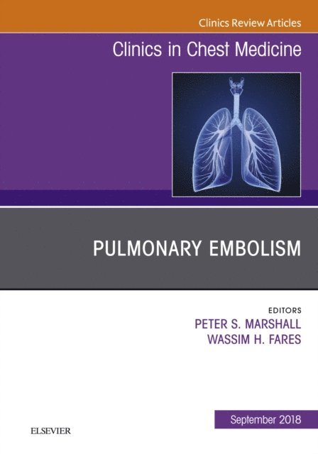 Wassim Fares, Peter Marshall - Pulmonary Embolism, An Issue of Clinics in Chest Medicine, E-bok