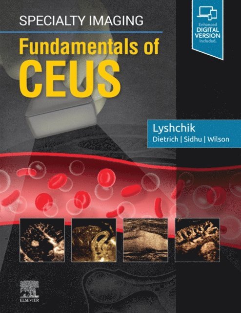 Andrej Lyshchik - Specialty Imaging: Fundamentals of CEUS E-Book, E-bok