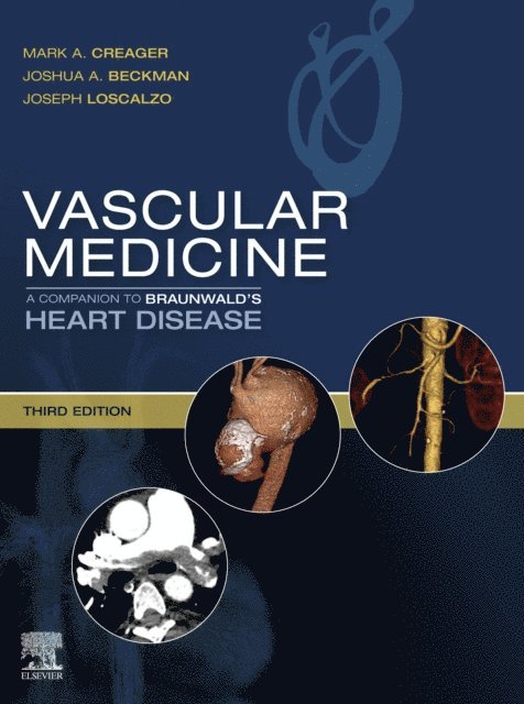 Joseph Loscalzo, Joshua A. Beckman, Mark Creager - Vascular Medicine: A Companion to Braunwald's Heart Disease E-Book, E-bok