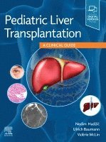 Nedim Hadzic, Ulrich Baumann, Val�rie MCLIN - Pediatric Liver Transplantation, Inbunden. Tillgänglighet: Lägg i varukorg