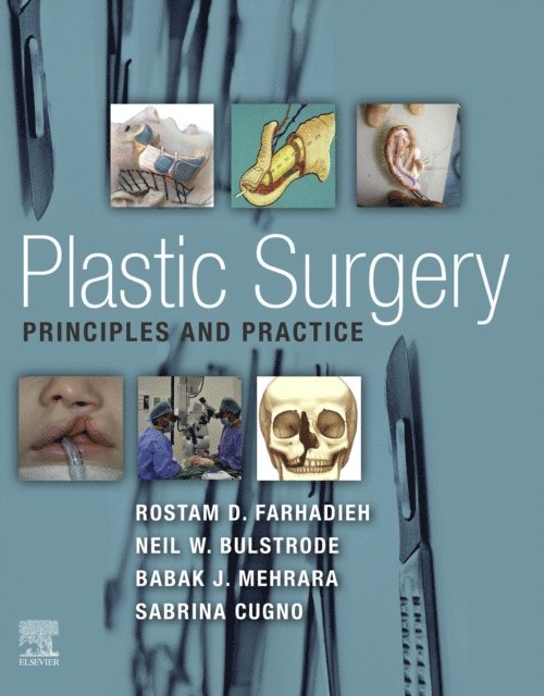 Sabrina Cugno, Babak J. Mehrara, Neil Bulstrode, Rostam Farhadieh - Plastic Surgery - Principles and Practice, E-bok