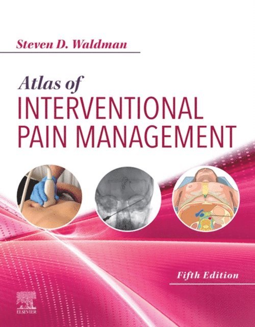 Steven D. Waldman - Atlas of Interventional Pain Management E-Book, E-bok