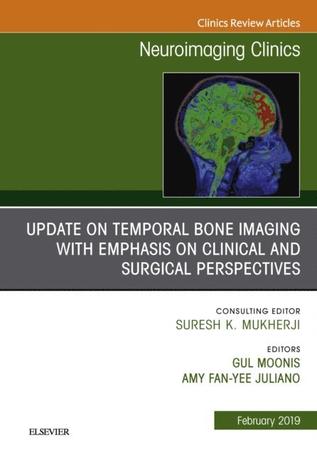 Amy Fan-Yee Juliano, Gul Moonis - Temporal Bone Imaging: Clinicoradiologic and Surgical Considerations, An Issue of Neuroimaging Clinics of North America, E-bok