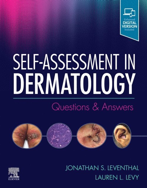 Lauren L. Levy, Jonathan Leventhal - Self-Assessment in Dermatology E-Book, E-bok. Tillgänglighet: Lägg i varukorg