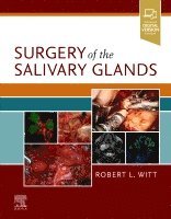 Robert L. Witt - Surgery of the Salivary Glands, Inbunden. Tillgänglighet: Lägg i varukorg