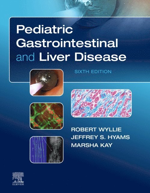 Marsha Kay, Jeffrey S. Hyams, Robert Wyllie - Pediatric Gastrointestinal and Liver Disease E-Book, E-bok