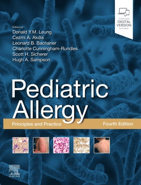 Hugh A. Sampson, Scott H Sicherer, Charlotte Cunningham-Rundles, Leonard B. Bacharier, Cezmi A Akdis, Donald Y. M. Leung - Pediatric Allergy,E-Book, E-bok