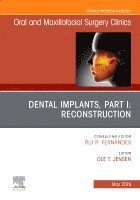 Ole Jensen - Dental Implants, Part I: Reconstruction, An Issue of Oral and Maxillofacial Surgery Clinics of North America, Inbunden
