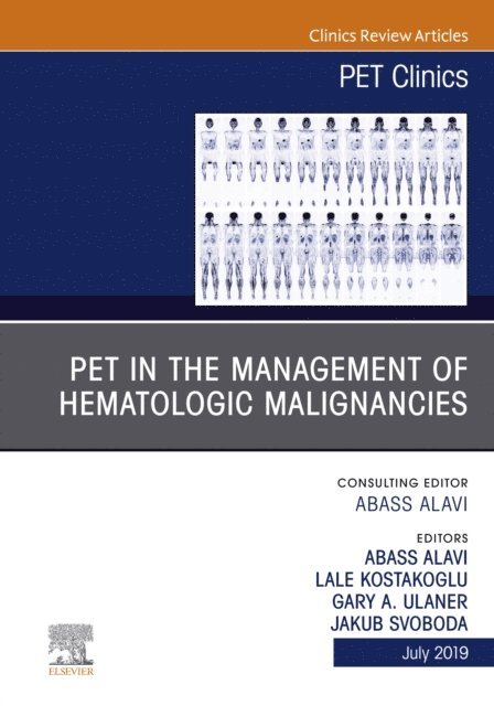 Lale Kostakoglu, Jakub Svoboda, Gary A. Ulaner, Abass Alavi - PET in the Management of Hematologic Malignancies, An Issue of PET Clinics, E-bok