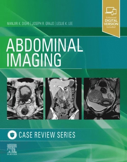 Leslie Lee, Joseph R. Grajo, Manjiri Dighe - Abdominal Imaging, E-bok