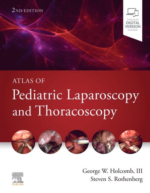 Steven S. Rothenberg, George W. Holcomb - Atlas of Pediatric Laparoscopy and Thoracoscopy, E-bok