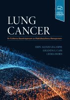 Erin Alexis Gillaspie, Leora Horn, Amanda S. Cass - Lung Cancer, Inbunden