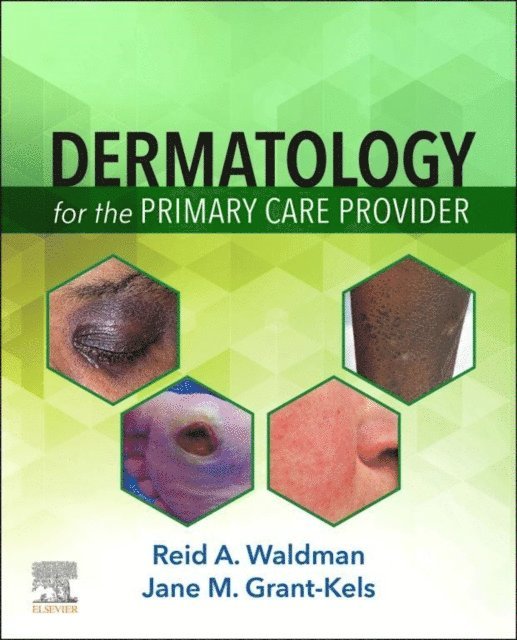 Jane M. Grant-Kels, Reid A. Waldman - Dermatology for the Primary Care Provider E-Book, E-bok
