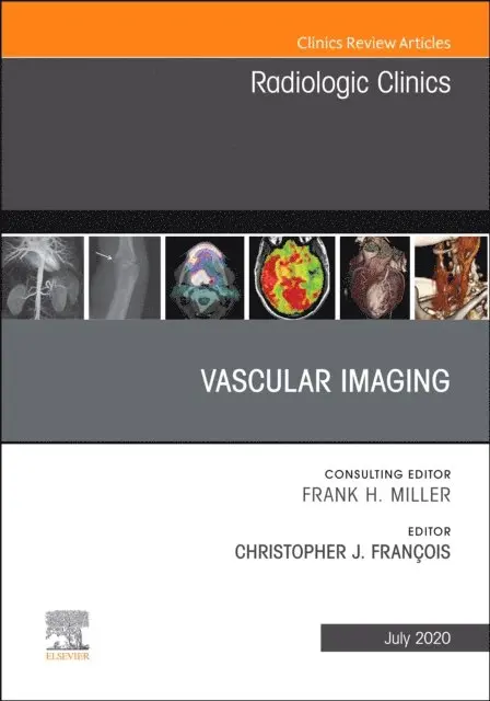 Vascular Imaging, An Issue of Radiologic Clinics of North America