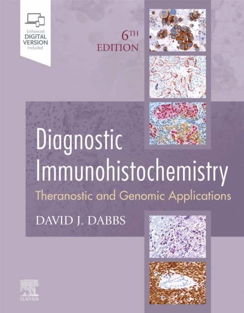 David J Dabbs - Diagnostic Immunohistochemistry E-Book, E-bok