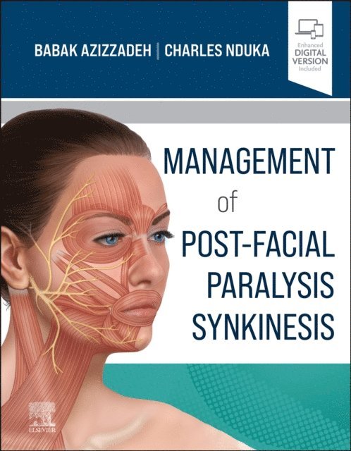 Charles Nduka, Babak Azizzadeh - Management of Post-Facial Paralysis Synkinesis, E-bok