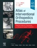 Atlas of Interventional Orthopedics Procedures, E-Book