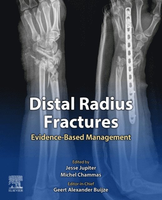 Michel Chammas, Jesse Jupiter, Geert Alexander Buijze - Distal Radius Fractures, E-bok