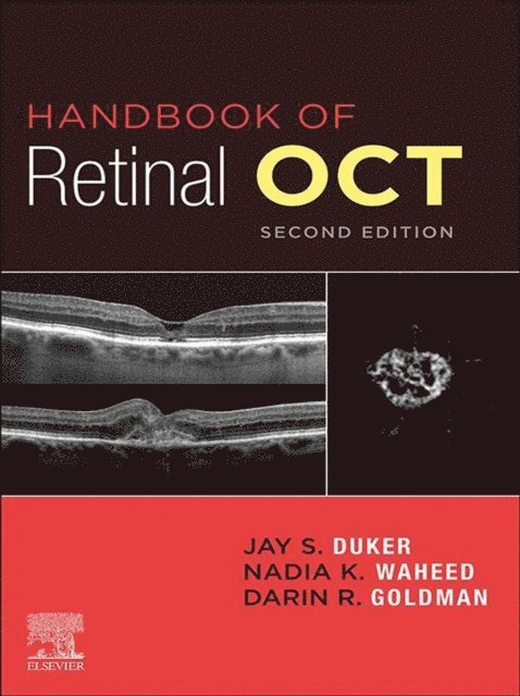 Darin Goldman, Nadia K. Waheed, Jay S. Duker - Handbook of Retinal OCT: Optical Coherence Tomography E-Book, E-bok