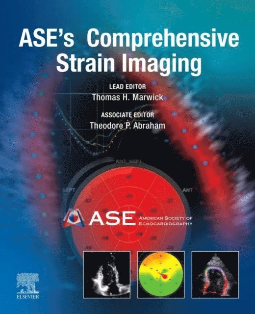 Theodore P. Abraham, Thomas H. Marwick - ASE's Comprehensive Strain Imaging, E-Book, E-bok
