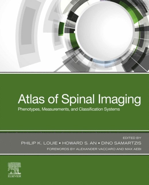 Dino Samartzis, Howard S. An, Philip K. Louie - Atlas of Spinal Imaging Phenotypes, E-bok