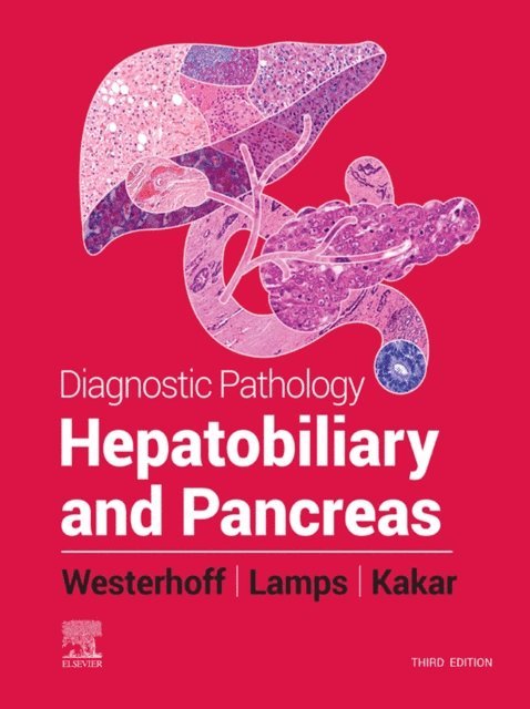 Sanjay Kakar, Maria Westerhoff, Laura W. Lamps - Diagnostic Pathology: Hepatobiliary and Pancreas E-Book, E-bok
