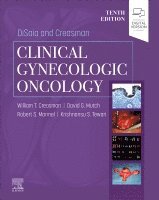 William T. Creasman, Robert S Mannel, David G Mutch, Krishnansu Tewari - DiSaia and Creasman Clinical Gynecologic Oncology, Inbunden
