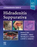 Vivian Y. Shi, Jennifer L. Hsiao, Michelle A. Lowes, Iltefat H. Hamzavi - A Comprehensive Guide to Hidradenitis Suppurativa, Inbunden. Tillgänglighet: Lägg i varukorg