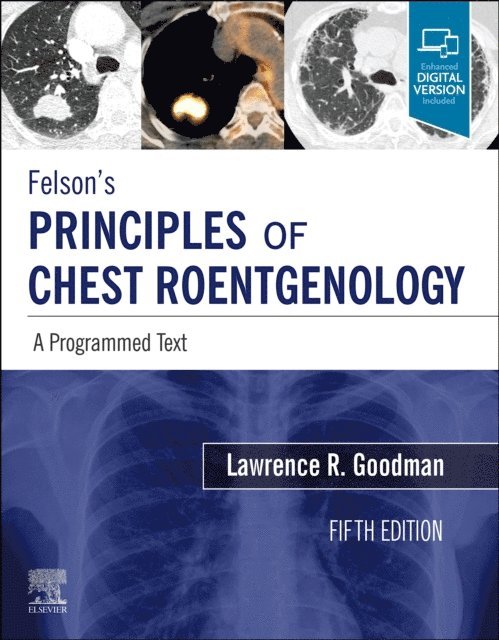 Lawrence R. Goodman - Felson's Principles of Chest Roentgenology E-Book, E-bok. Tillgänglighet: Lägg i varukorg