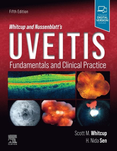 H. Nida Sen, Scott M. Whitcup - Whitcup and Nussenblatt's Uveitis, E-bok