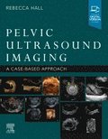 Pelvic Ultrasound Imaging