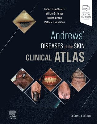 Andrews' Diseases of the Skin Clinical Atlas av Robert G Micheletti, William D James, Dirk M Elston, Patrick J McMahon, Robert G Micheletti