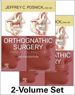 Orthognathic Surgery - 2 Volume Set av Jeffrey C Posnick