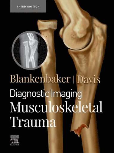 Kirkland W. Davis, Donna G. Blankenbaker - Diagnostic Imaging: Musculoskeletal Trauma,E-Book, E-bok