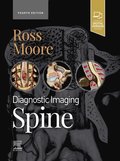 Diagnostic Imaging: Spine - E-Book