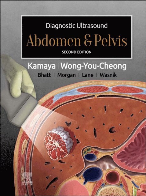 Jade Wong-You-Cheong, Aya Kamaya - Diagnostic Ultrasound: Abdomen and Pelvis E-Book, E-bok