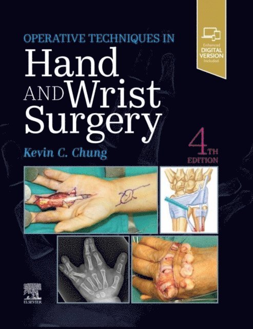 Kevin C. Chung - Operative Techniques: Hand and Wrist Surgery E-Book, E-bok