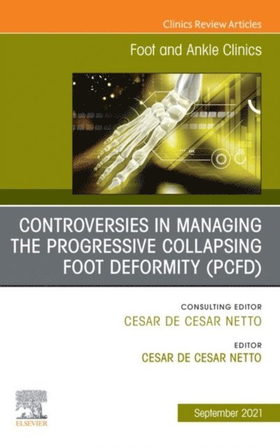 Cesar de Cesar Netto - Controversies in Managing the Progressive Collapsing Foot Deformity (PCFD), An issue of Foot and Ankle Clinics of North America, E-Book, E-bok