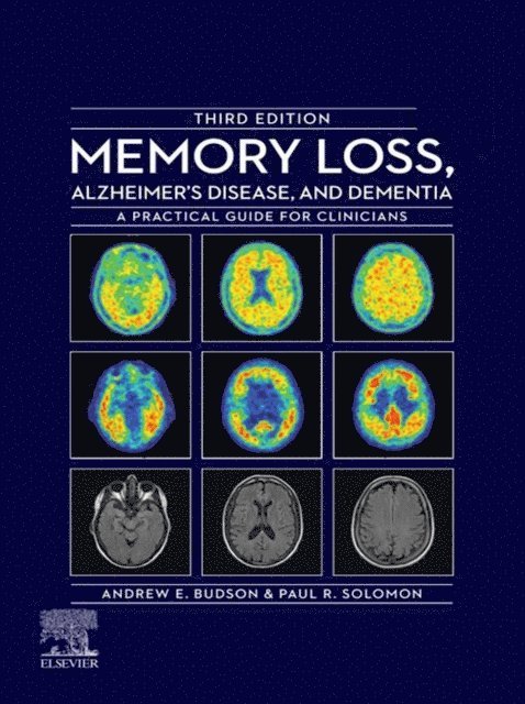 Paul R. Solomon, Andrew E. Budson - Memory Loss, Alzheimer's Disease, and Dementia - E-Book, E-bok
