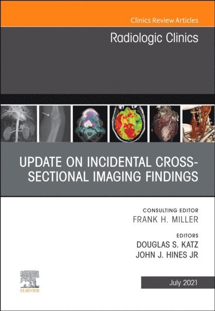 John Hines, Douglas G Katz - Update on Incidental Cross-sectional Imaging Findings, An Issue of Radiologic Clinics of North America, EBook, E-bok