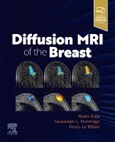 Mami Iima, Savannah Partridge, Denis Le Bihan - Diffusion MRI of the Breast, Häftad
